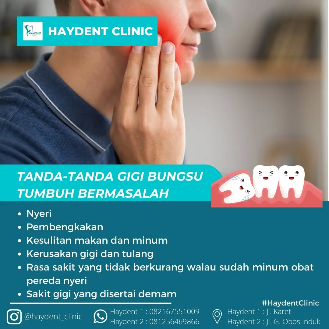 Jika mengalami salah satu tanda-tanda di atas, sebaiknya segera periksakan diri ke dokter gigi